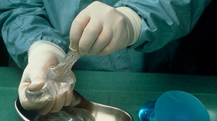 Ce trebuie să știi despre implanturile mamare. Ioana s-a operat la sâni săptămâna trecută