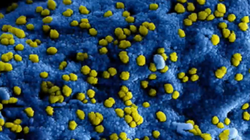 Uite care e „cea mai rezistentă bacterie“. Nu moare nici în spațiu