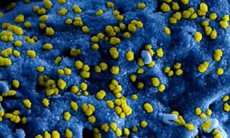 Uite care e „cea mai rezistentă bacterie“. Nu moare nici în spațiu