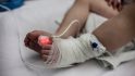 Bebeluș, în stare gravă la spital după ce a căzut peste el o oală cu bulion încins
