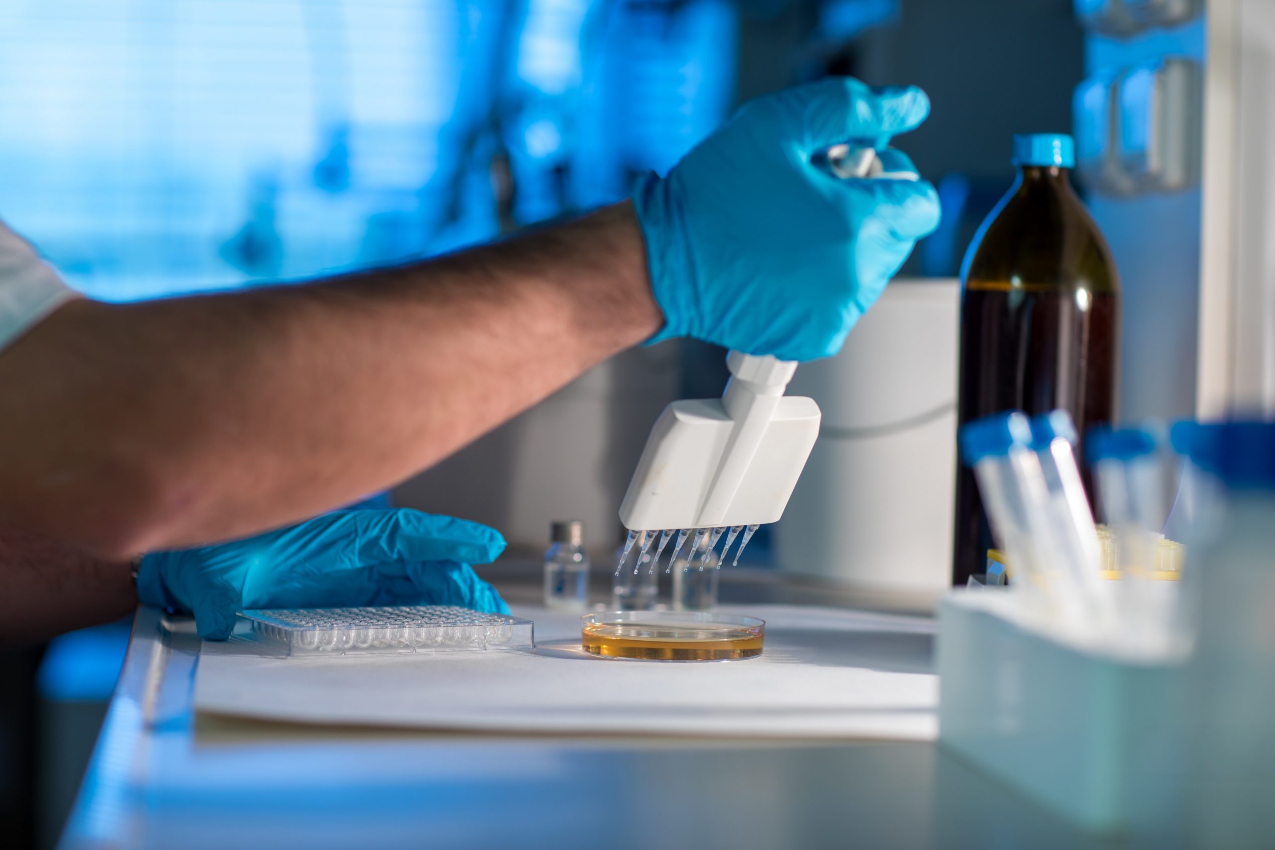 China încearcă să sugereze că panedmia nu a izbucnit în Wuhan. Presa de stat prezintă mai multe dovezi despre originea coronavirusului