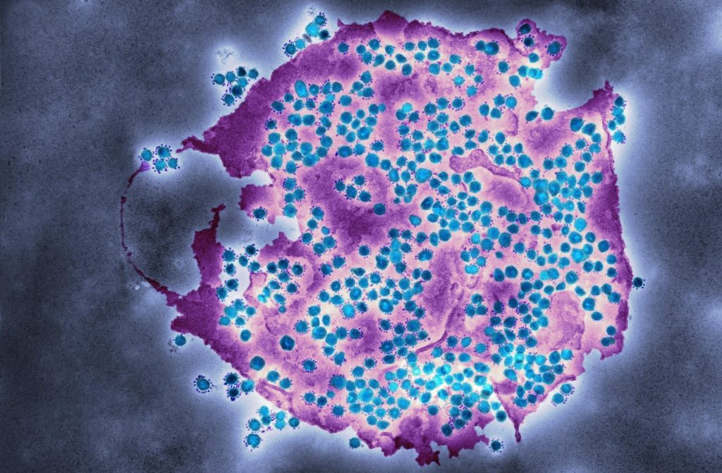 Coronavirus