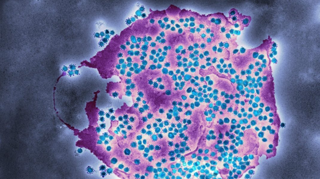 Coronavirus