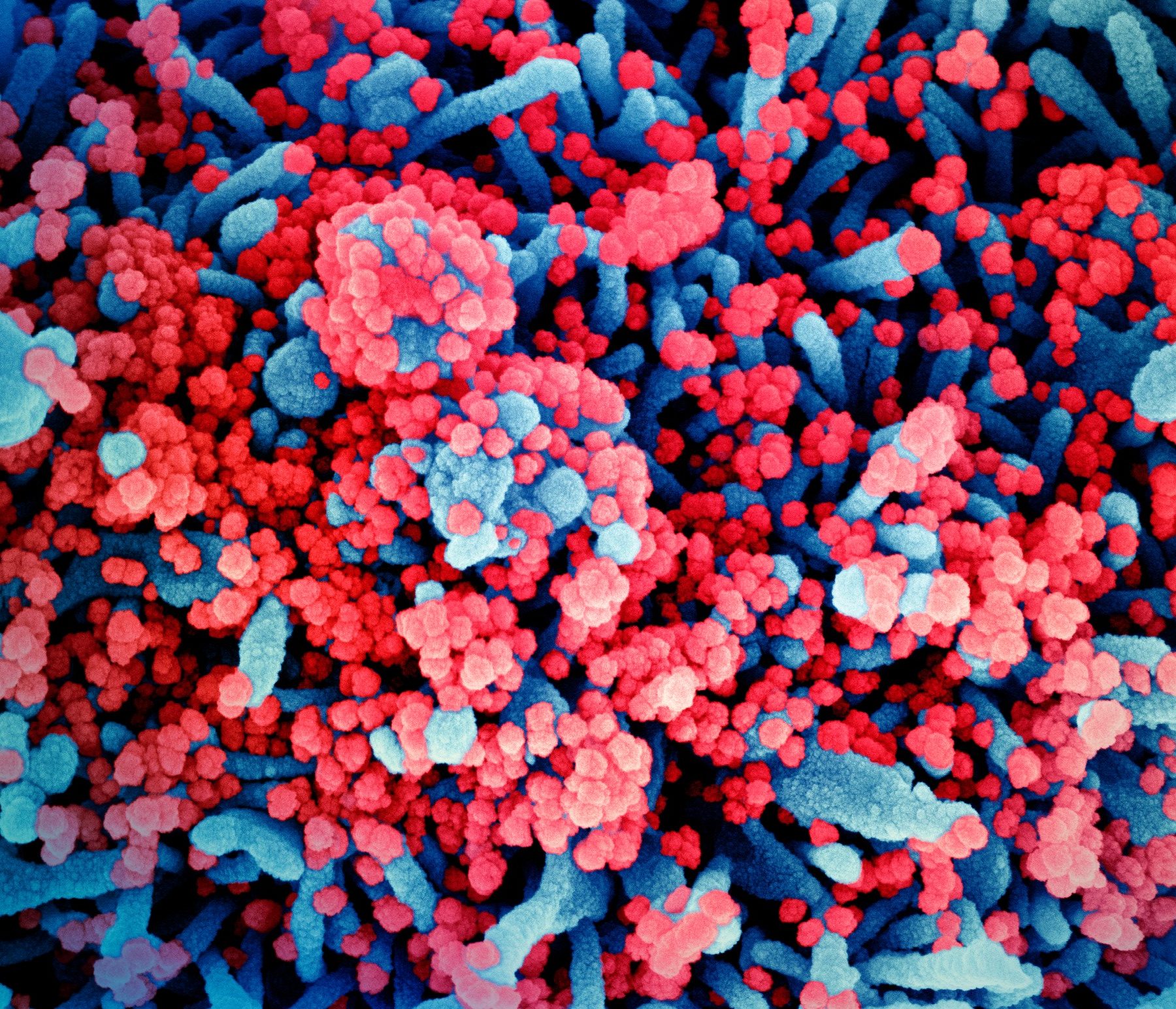 Coronavirus în lume live update 21 septembrie 2020. Virusul a suferit până acum 7 mutații