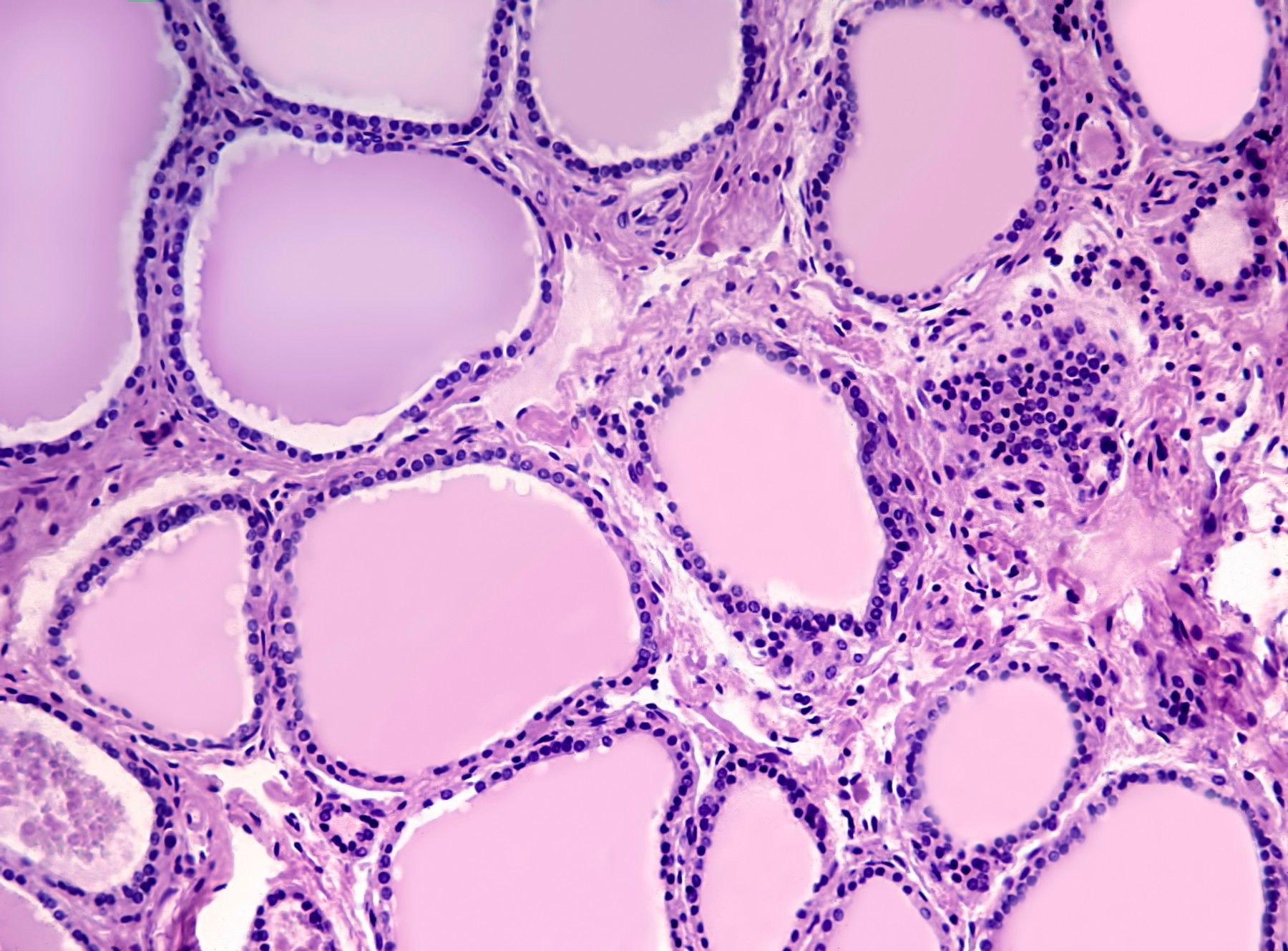 Cercetătorii endrocrinologi au descoperit o nouă genă responsabilă de libidoul bărbaților