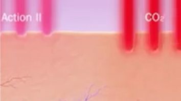 Un nou studiu arată că laserul cu CO2 stimulează funcția sexuală a femeii