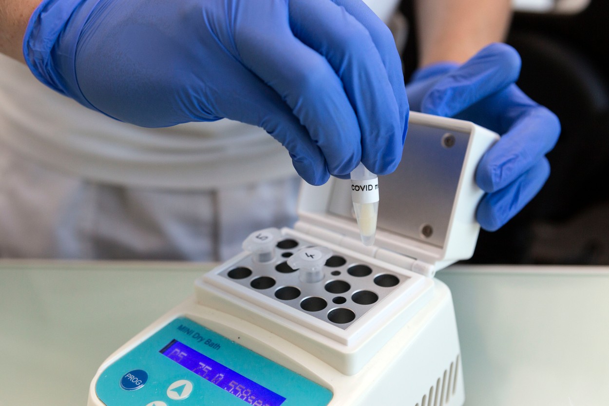 Britanicii se pregătesc să facă un milion de teste pe zi, în timp ce România efectuează 30.000 de teste zilnic. Care este explicația