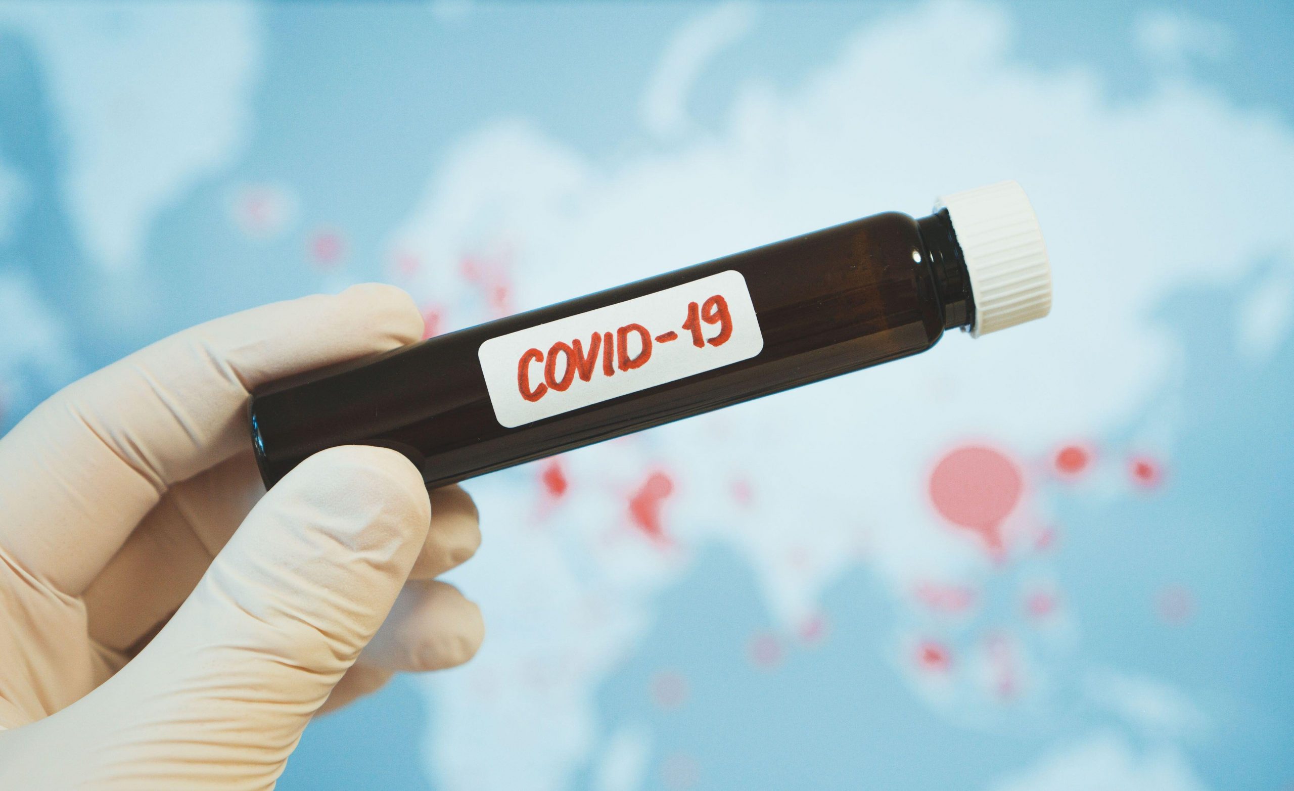 Coronavirus în lume: 378.000 de îmbolnăviri la nivel mondial și 8.500 de decese într-o singură zi