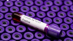Coronavirus în România, 11 octombrie. Județul cu 413 cazuri noi raportate în ultimele 24 de ore