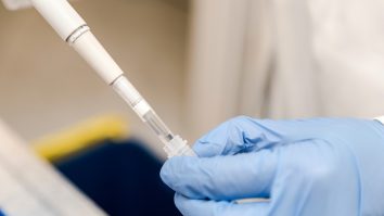 Risc major în faţa COVID-19 pentru bărbaţii cu ficat gras nonalcoolic