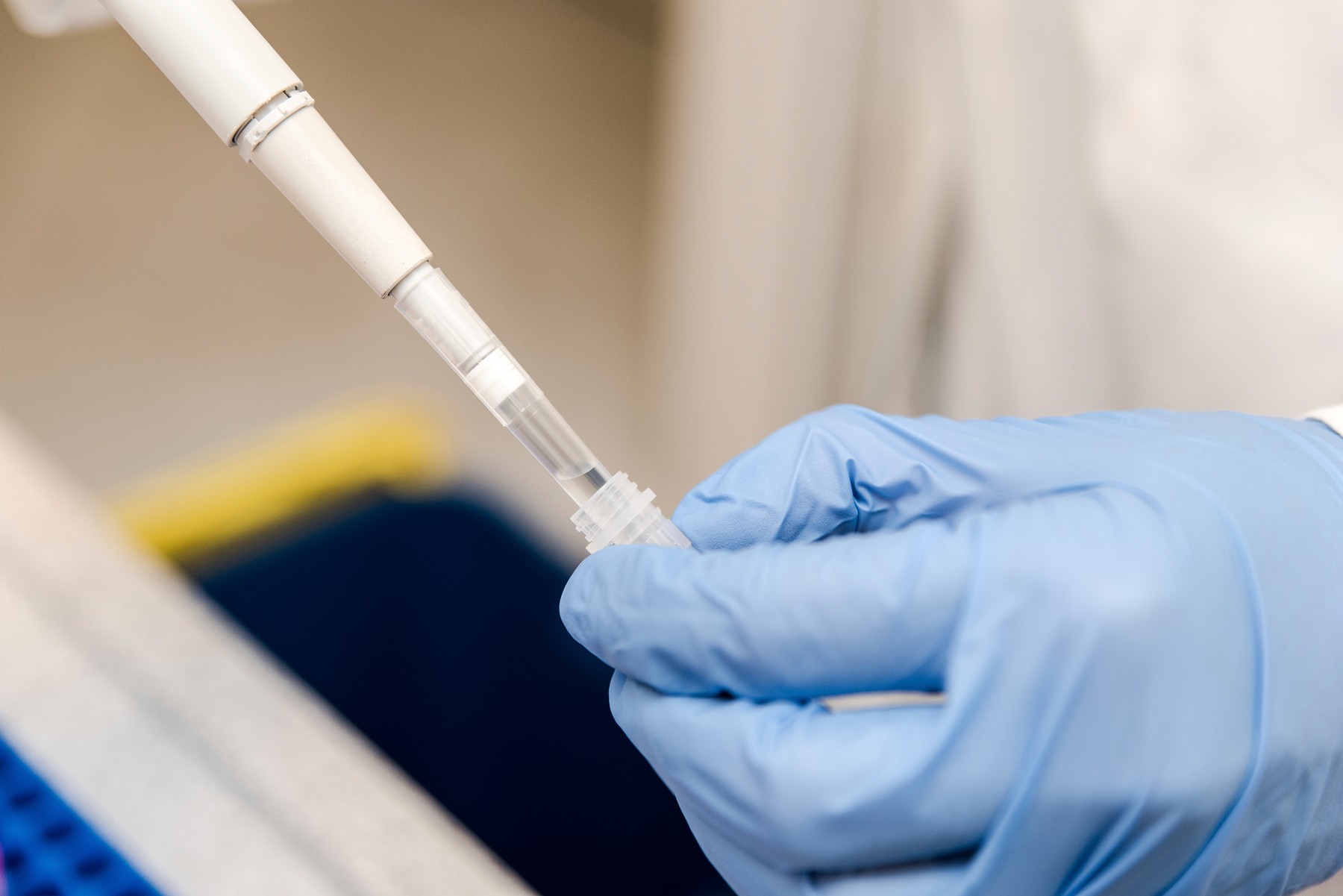 Risc major în faţa COVID-19 pentru bărbaţii cu ficat gras nonalcoolic