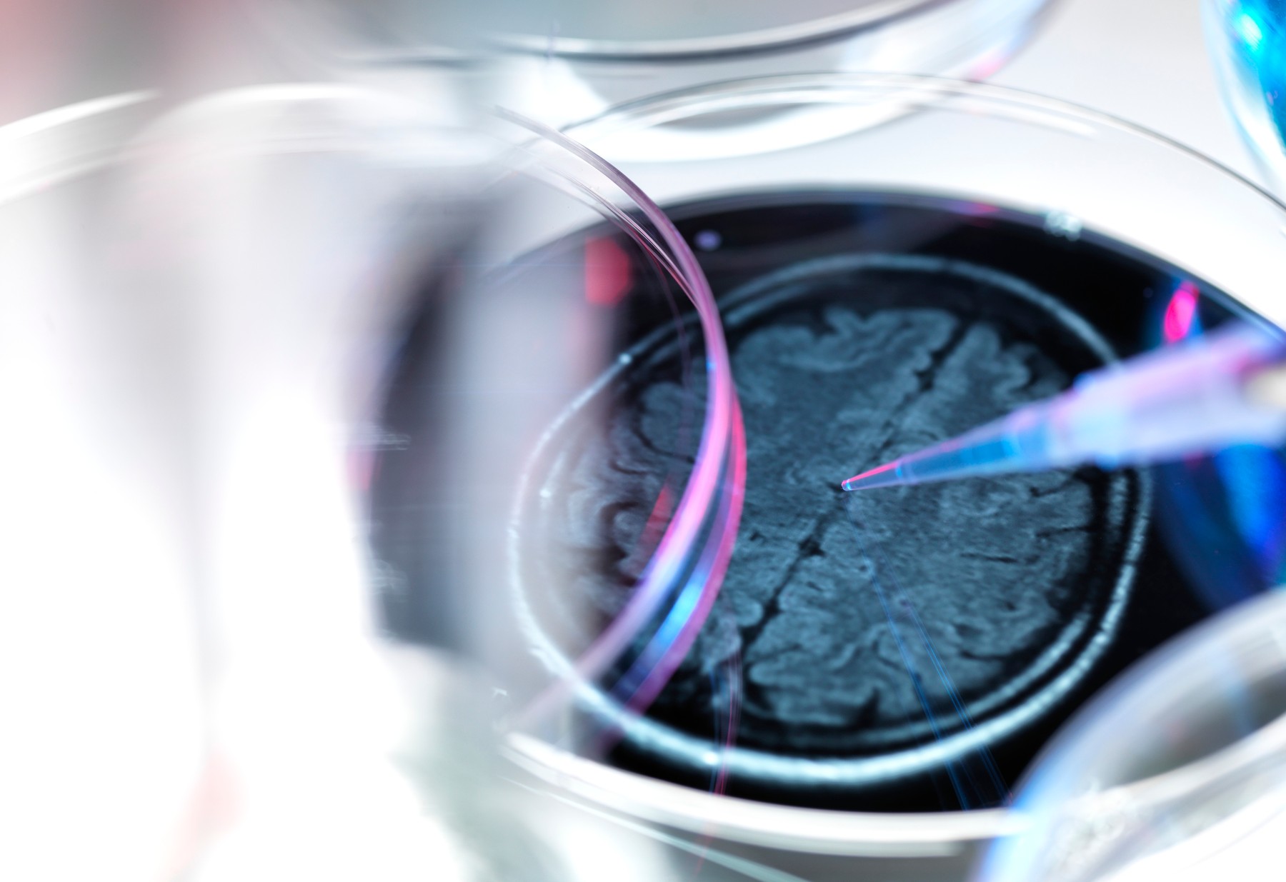 O nouă descoperire arată că apa rece ar putea preveni și trata demența