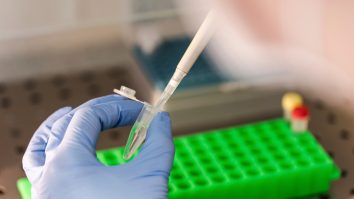 250 de australieni au fost testați pentru COVID-19 cu același dispozitiv. Sunt chemați la analize pentru HIV