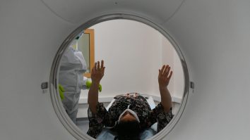 29 octombrie, Ziua mondială a Atacului Vascular Cerebral. Cum poate fi prevenită această boală