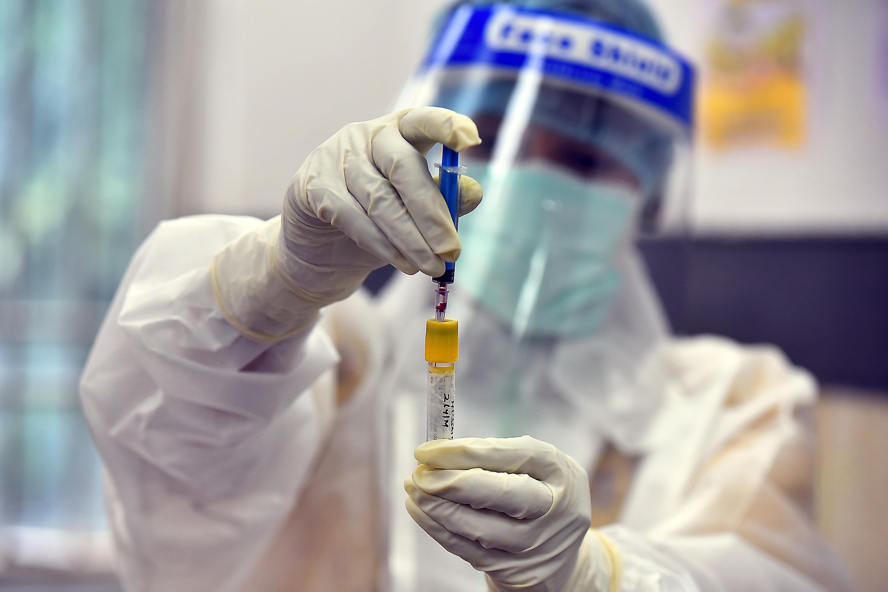 În România nu se donează plasmă pentru bolnavii de COVID, din cauza numărului mic de teste de imunitate