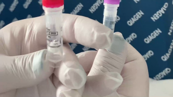 SJU Craiova, fonduri europene de 3.2 milioane de euro pentru echipamente și dezinfectanți. Nu se mai fac teste la cerere