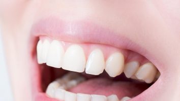 Cercetătorii spun că râsul e cel mai bun medicament. Toni Grecu: „România se hrănește cu umor”