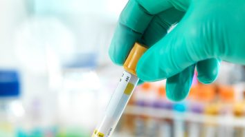 Primul tratament injectabil pentru HIV a primit undă verde de la Agenţia Europeană a Medicamentului
