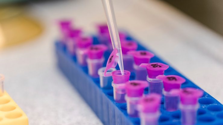 O companie americană anunţă că a creat un nou tip de test rapid, cu o acuratețe de peste 90%