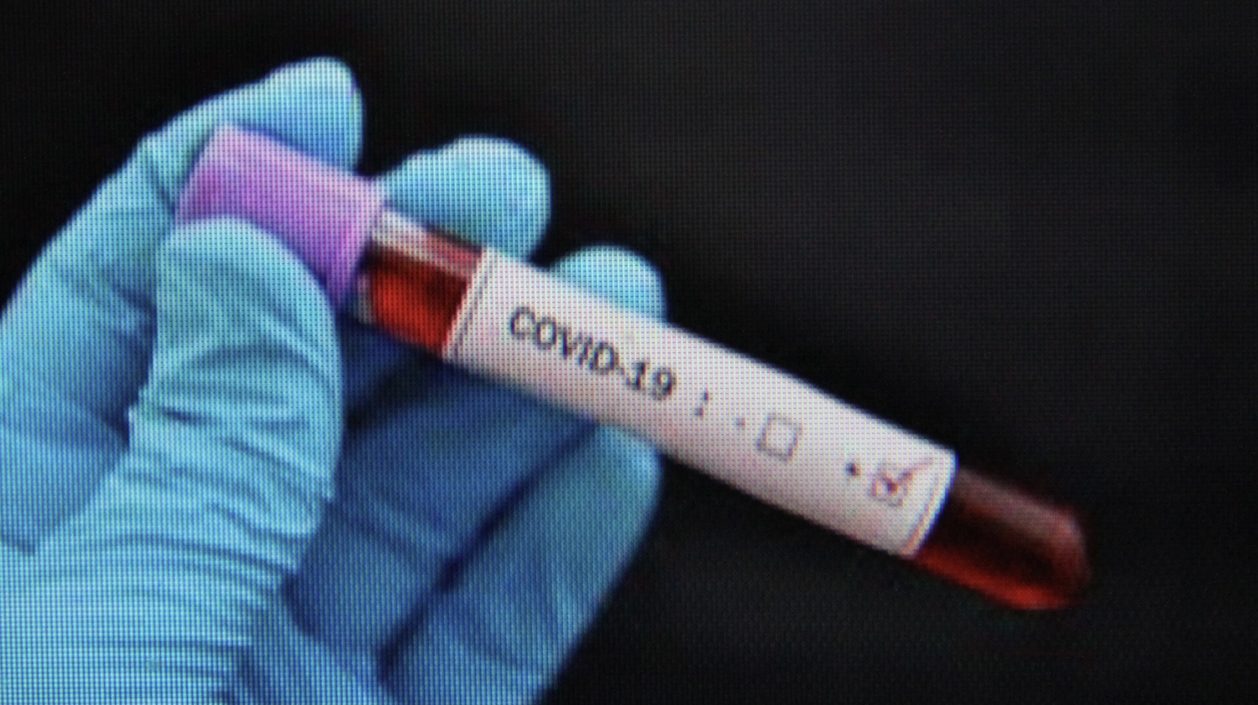 Virusul SARS-CoV-2 suferă mutații constant, dar nu se transmite mai ușor