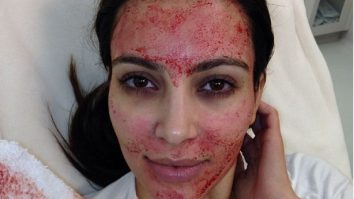 Ce este „Terapia Vampir”? Elimină ridurile, cearcănele și acneea