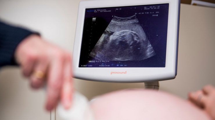 Bebeluș ultrasunete