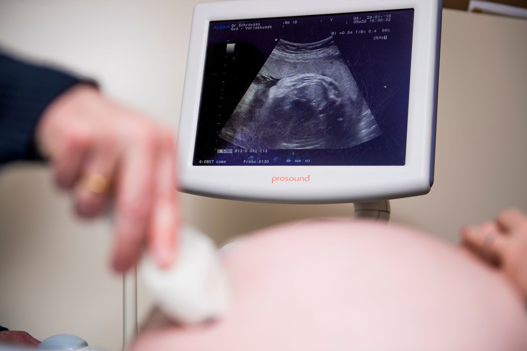 „E ca și cum ai avea un bebeluș-cyborg”. Microparticule de plastic, descoperite pentru prima dată în placenta copiilor nenăscuți