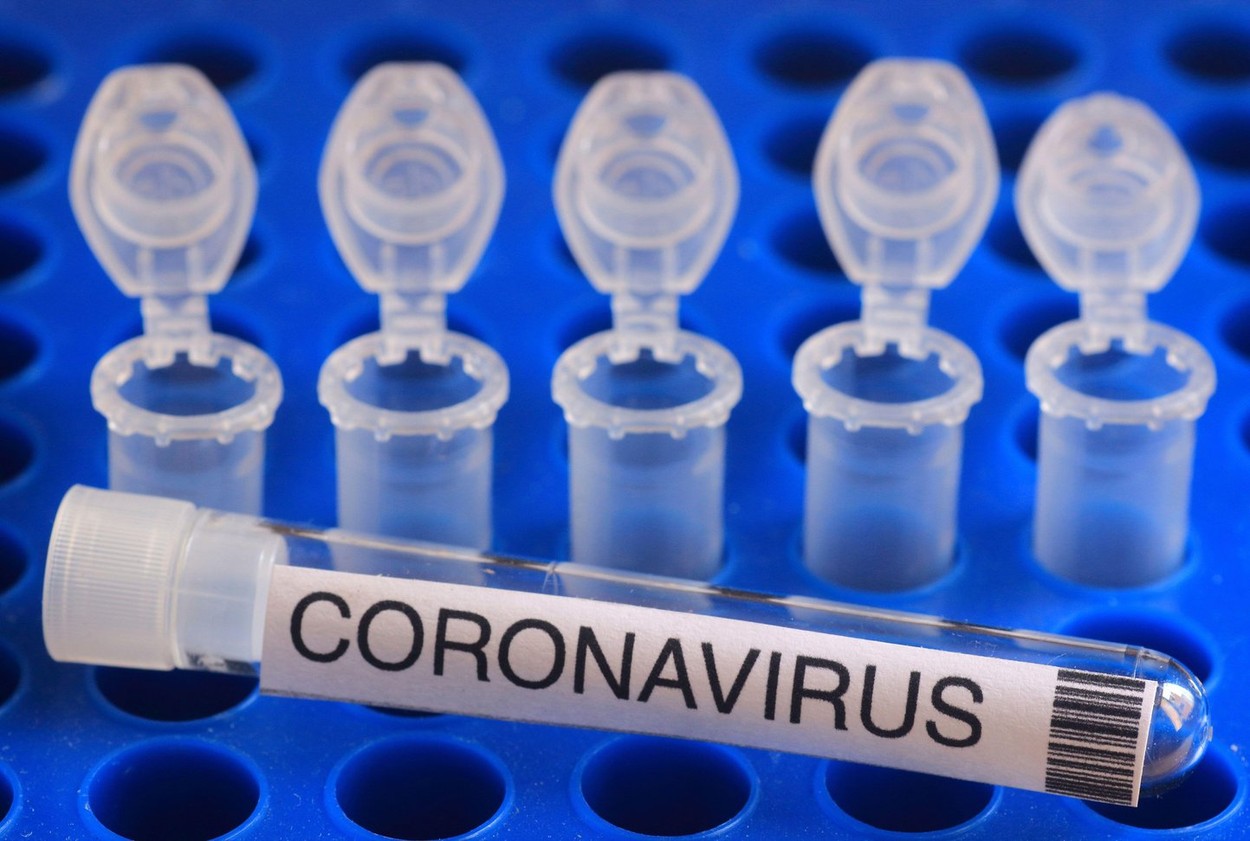 Metoda revoluţionară de testare pentru Covid-19, inventată în SUA. Cum funcționează