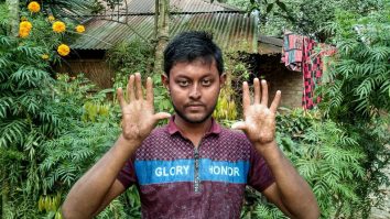 Povestea familiei fără amprente. Problemele pe care le întâmpină din cauza mutației genetice rare. FOTO