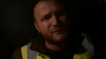 Activistul Daniel Bodnar, plin de sânge după ce a fost atacat de tăietorii ilegali de lemne, mesaj pentru Vela: „Voi sunteți asasinii României!”