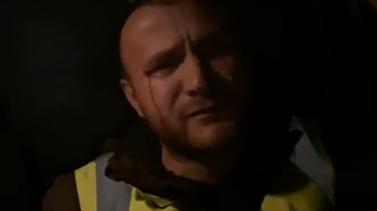 Activistul Daniel Bodnar, plin de sânge după ce a fost atacat de tăietorii ilegali de lemne, mesaj pentru Vela: „Voi sunteți asasinii României!”