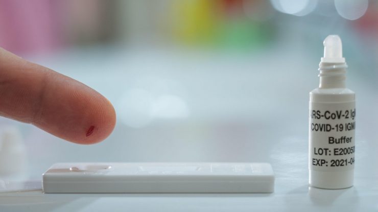 SUA autorizează primul test Covid-19 la domiciliu, fără prescripție medicală. Afli rezultatul în 20 de minute