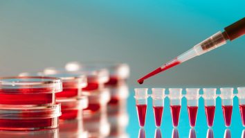 Cercetătorii dezvoltă un test de sânge eficient pentru detectarea anxietății