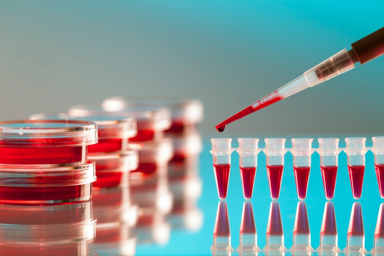 Testul de sânge care determină dacă va funcționa chimioterapia