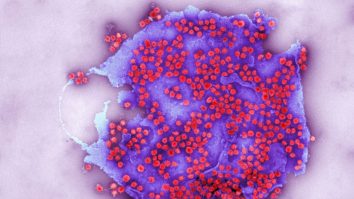 Dr. Radu Țincu: Este o mare problemă dacă nu reuşim să finalizăm campania de vaccinare înainte ca virusul să sufere mutaţii