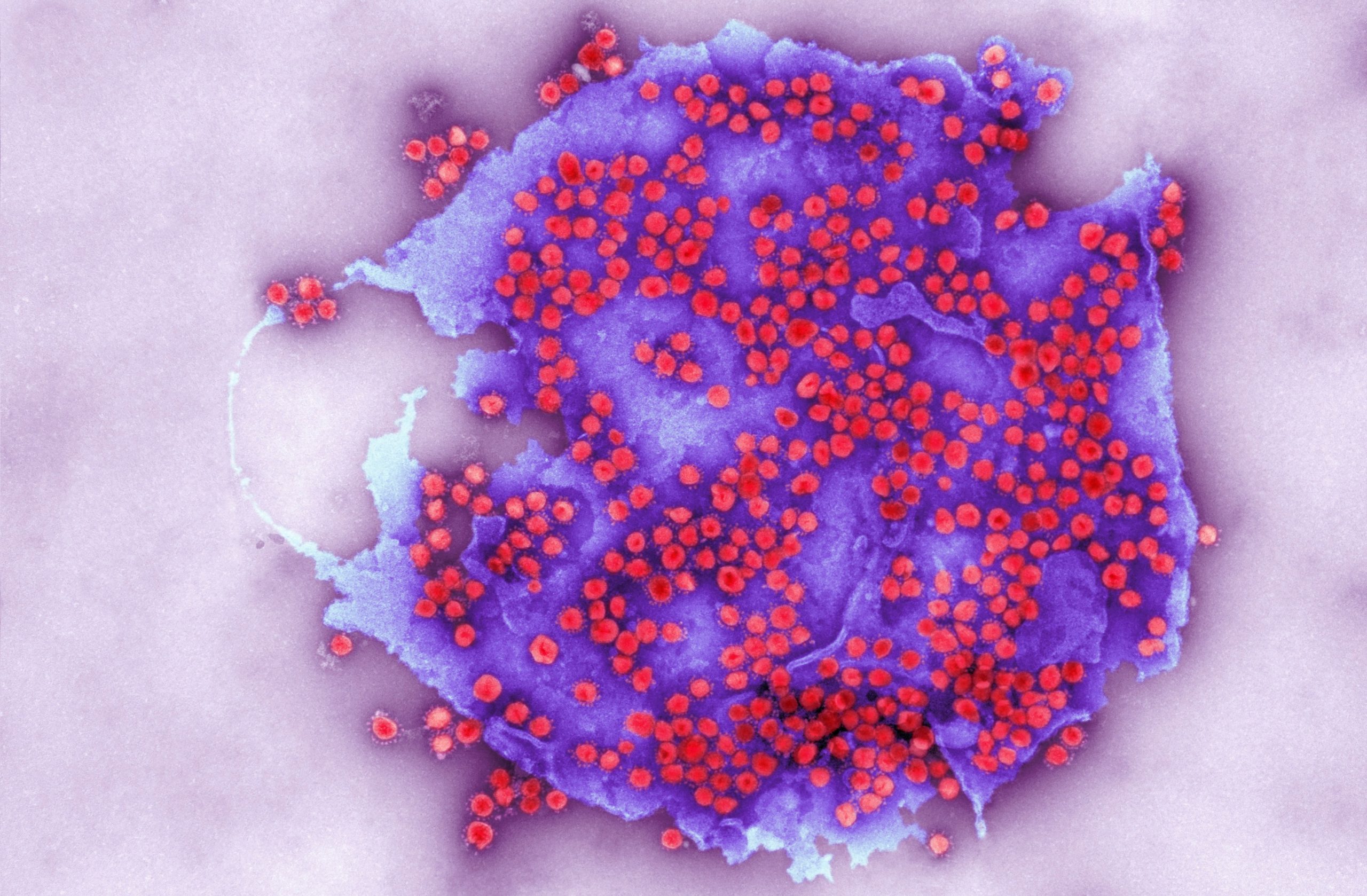 Tulpina britanică de Covid-19 a suferit o nouă mutație