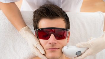 Epilarea cu laser, tot mai populară printre bărbați.  Un clujean a explicat de ce a ales procedura