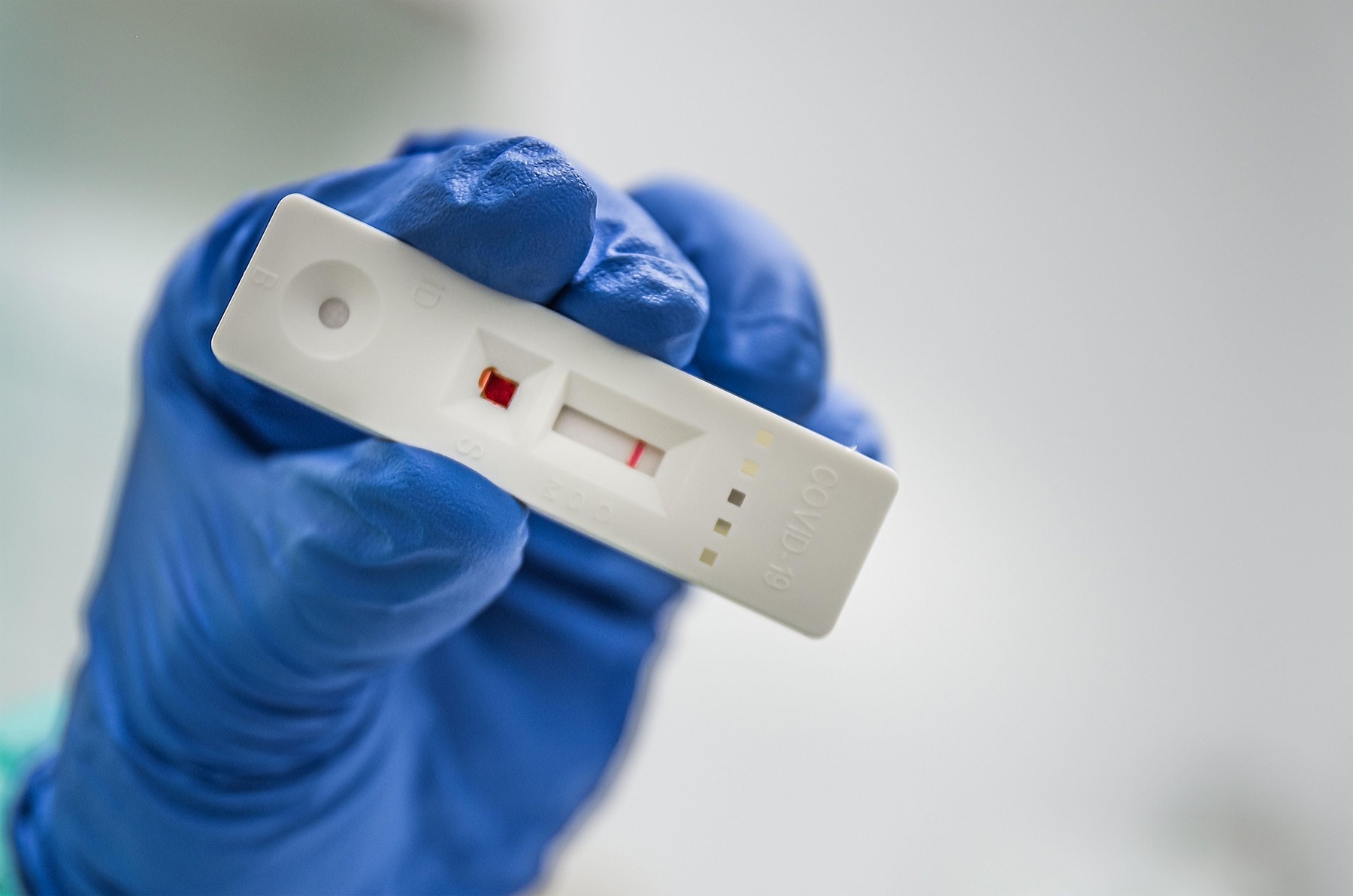 Testele antigen, de ajuns pentru a depista COVID-19. Medic infecționist: „Ar trebui efectuate într-o unitate medicală pentru a ști că a fost recoltat corect”