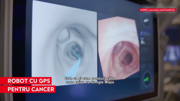 Robotul care poate detecta cancerul pulmonar. Are o eficienţă de 80%
