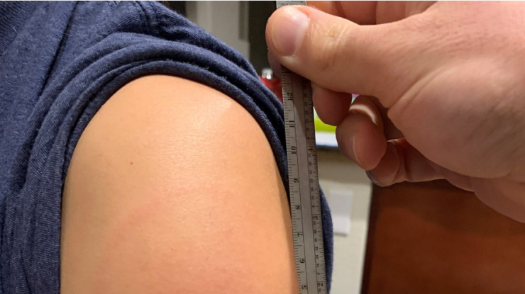 Care este probabilitatea să faci tromboză după vaccinarea cu AstraZeneca? „Să câștigi la loto cu 450 de bilete”