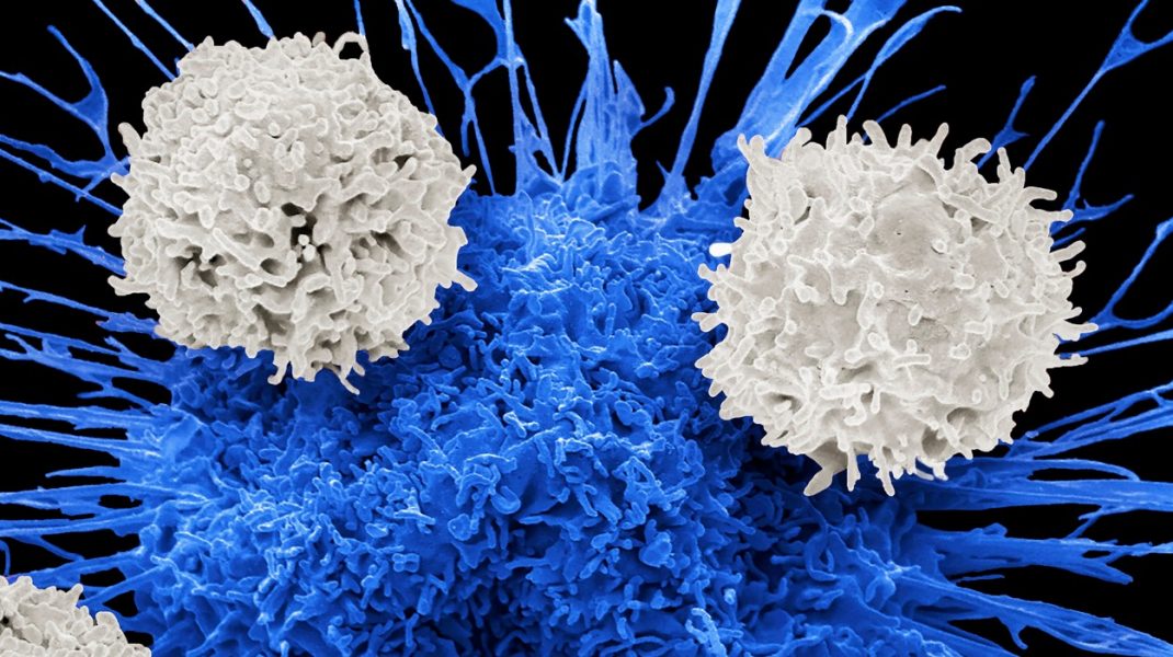 Celule T