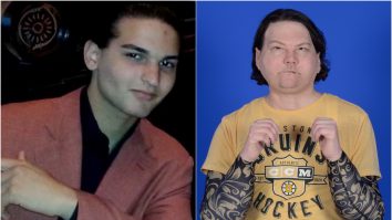 Un tânăr de 22 de ani, ars în urma unui accident, a primit un transplant rar de mâini și față