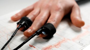 Scandal într-o primărie din Neamț. Primărița i-ar fi rupt maxilarul viceprimarului. „Voi cere verificare cu detectorul de minciuni”