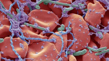 Boala care te face de nouă ori mai predispus la deces din cauza infecției cu Sars-Cov-2