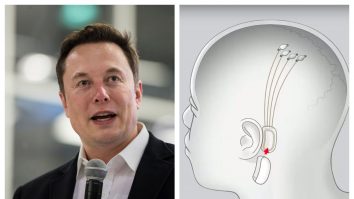 Elon Musk vrea să implanteze microcipuri în creierele oamenilor. Tot ce trebuie să știi despre Neuralink