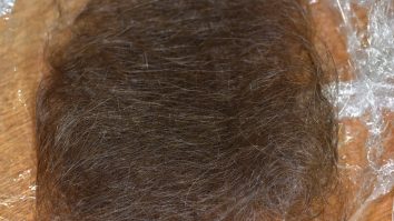 O femeie a aflat că este infectată cu SARS-CoV-2 după ce a început să chelească: „Părul meu a căzut în grămezi mari. A fost îngrozitor!”