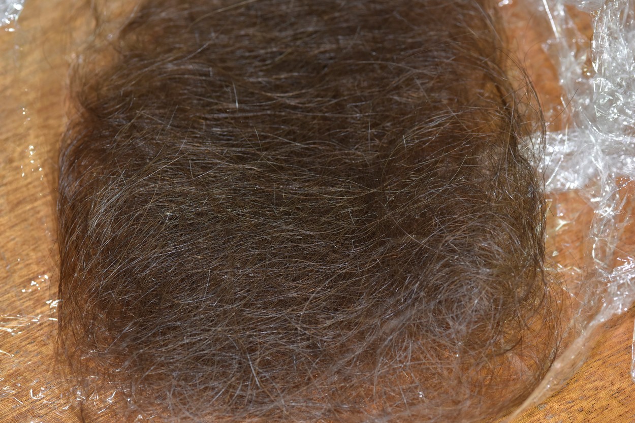 O femeie a aflat că este infectată cu SARS-CoV-2 după ce a început să chelească: „Părul meu a căzut în grămezi mari. A fost îngrozitor!”