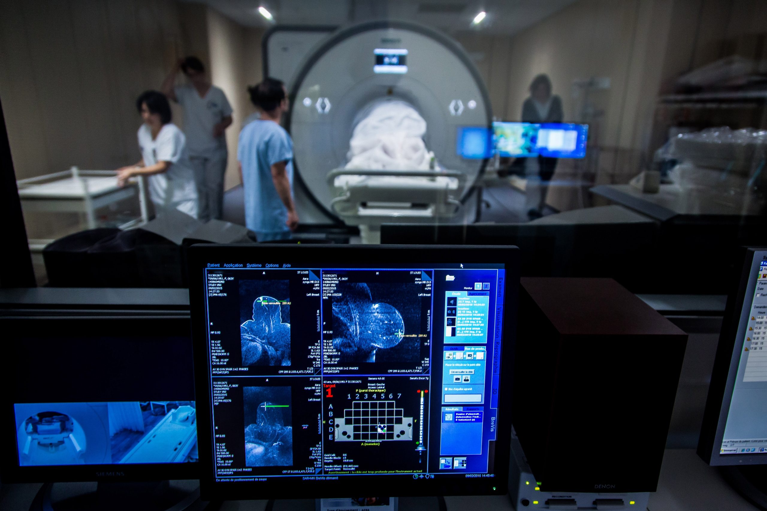 Premieră medicală la Timișoara: investigație modernă a cancerului la sân