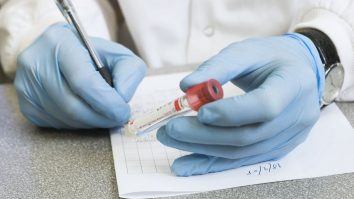 Cercetătorul care a dezvoltat primul test rapid de salivă pentru depistarea coronavirusului a murit la 51 de ani