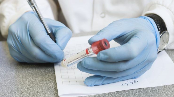 Cercetătorul care a dezvoltat primul test rapid de salivă pentru depistarea coronavirusului a murit la 51 de ani